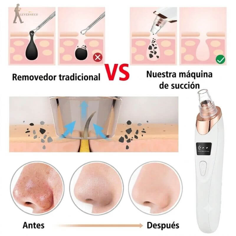 Kit PoroClean - Extrae hasta los puntos negros más viejos
