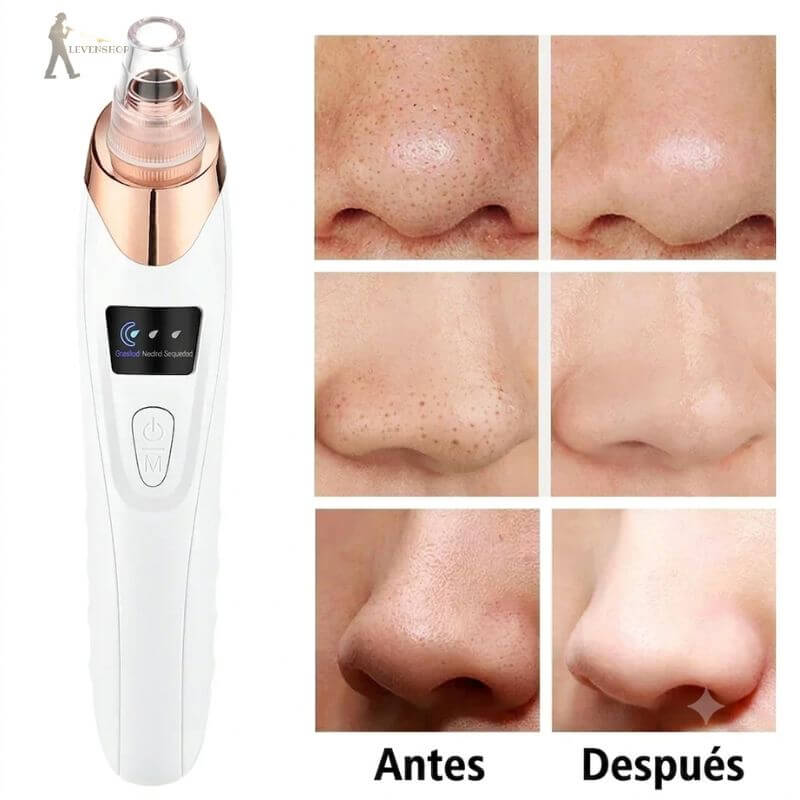 Kit PoroClean - Extrae hasta los puntos negros más viejos